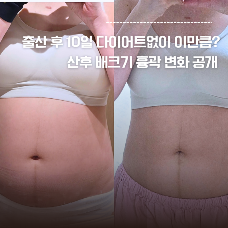 출산 후 다이어트 안 했는데 10일 만에 이만큼?｜몸무게 배·흉곽 변화 관찰 기록