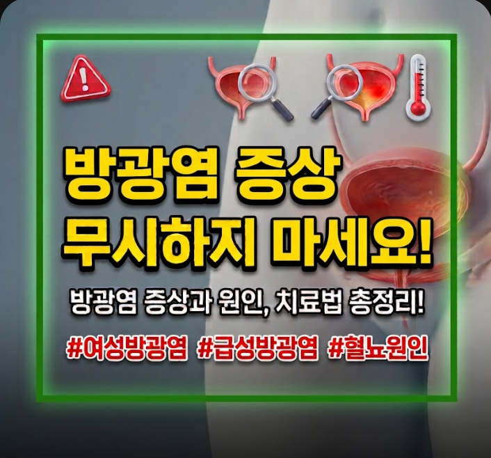 방광염 증상 급성과 만성 구분법 및 여성 남성 차이점은 무엇일까?