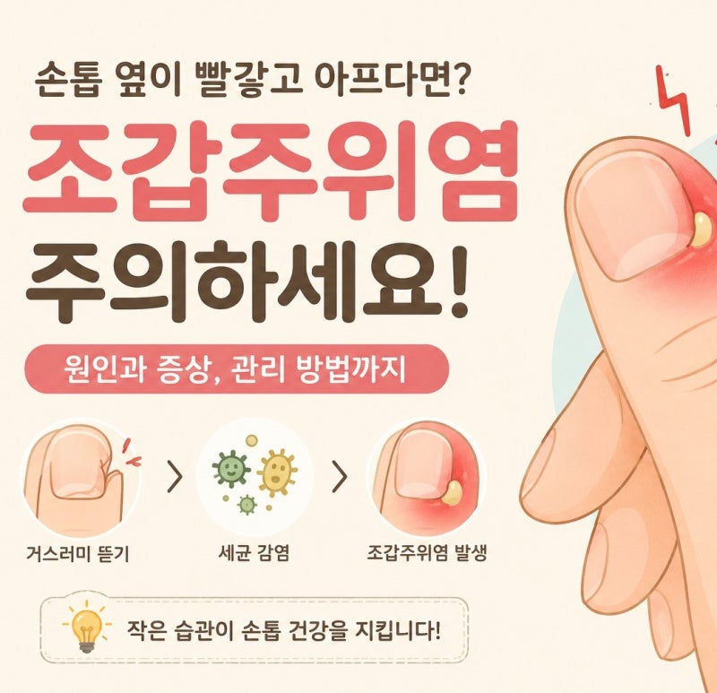 손톱 거스러미 함부로 뜯지 마세요! 조갑주위염 생기는 이유