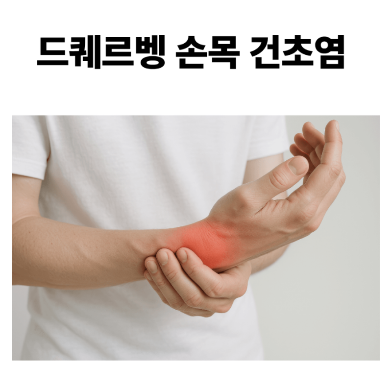 엄지손가락 쪽 손목이 아파요 - 드퀘르벵 건초염 치료 사례