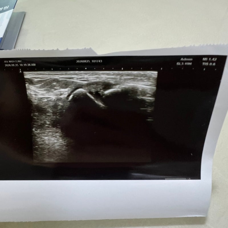 발목인대 나가서 MRI 찍고 주사 맞기☠️