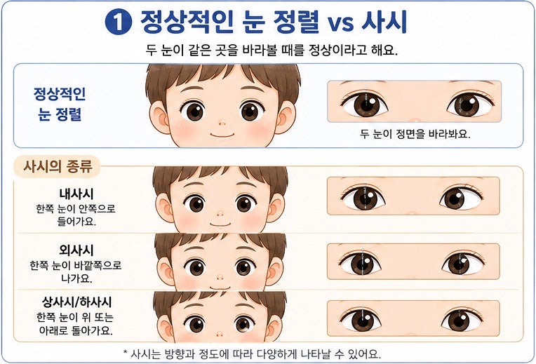 우리 아이 눈이 한쪽으로 몰려요 (소아 사시, 증상부터 치료와 수술까지 알아보기)