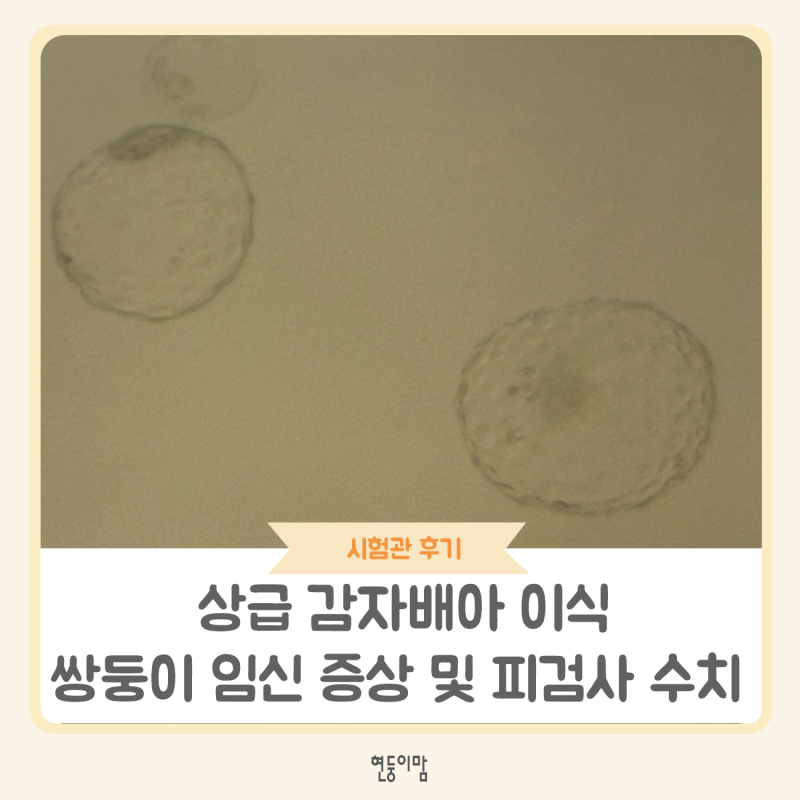 5일배양 배아 이식 후 쌍둥이 임신 증상과 임테기 변화 공유(피검수치는?)