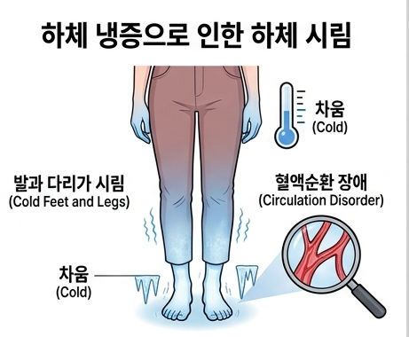 [수술 전 기록 ②] 골반울혈증후군 증상, 근종 & 로봇 수술까지