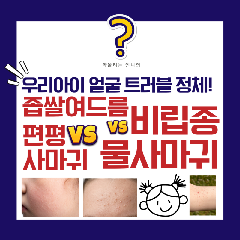 아이 얼굴 좁쌀 여드름? 비립종·물사마귀·편평사마귀 구분법