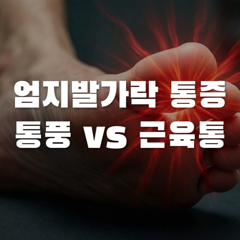 엄지발가락이 타는 듯한 통증, 그냥 피로 때문일까요? 통풍 vs 족저근막염 완벽 구분법