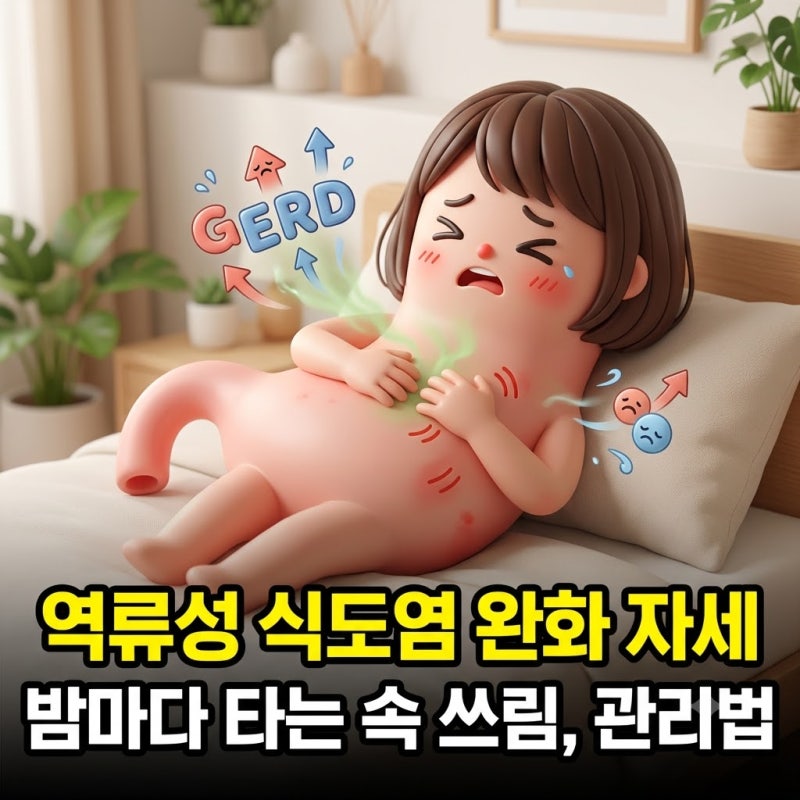밤마다 타는 속 쓰림, 역류성 식도염 완화 자세와 관리법