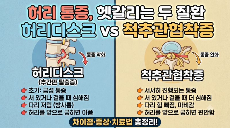 허리디스크 vs 척추관협착증 차이 치료법 비교 총정리
