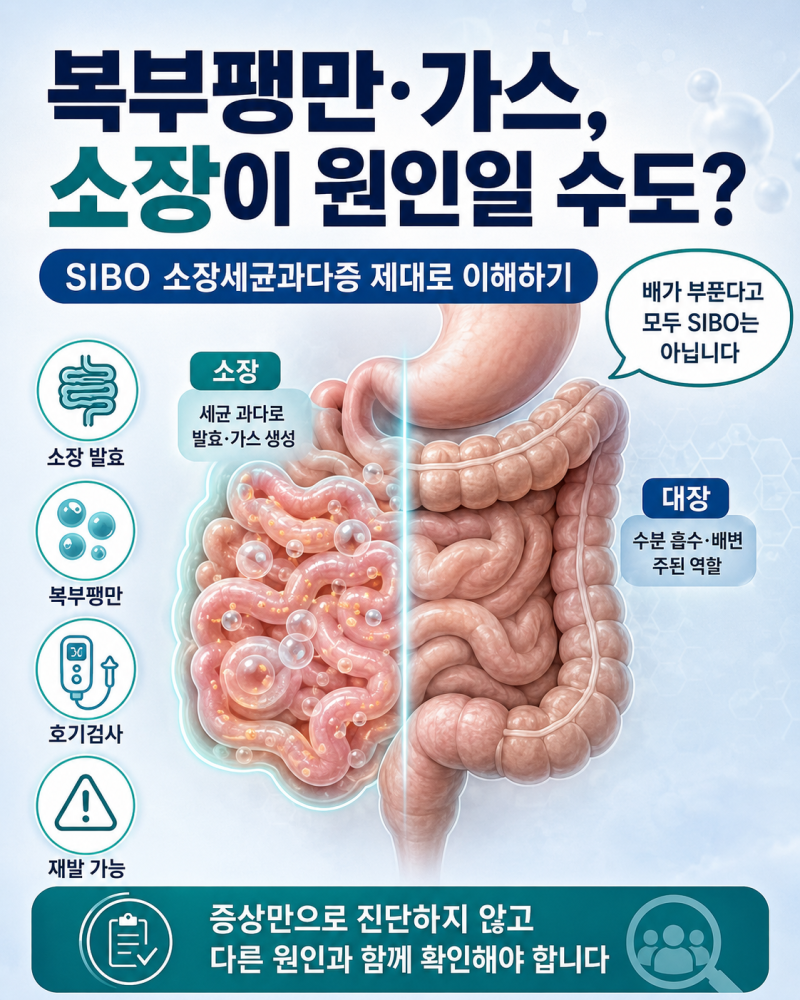 복부팽만 가스가 계속 찬다면 SIBO? 소장세균과다증 원인·검사·재발 정리