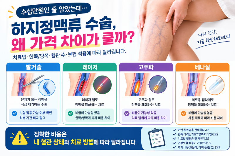 30만원이면 될 줄 알았는데 하지정맥류 수술 비용, 치료법 따라 차이 큽니다