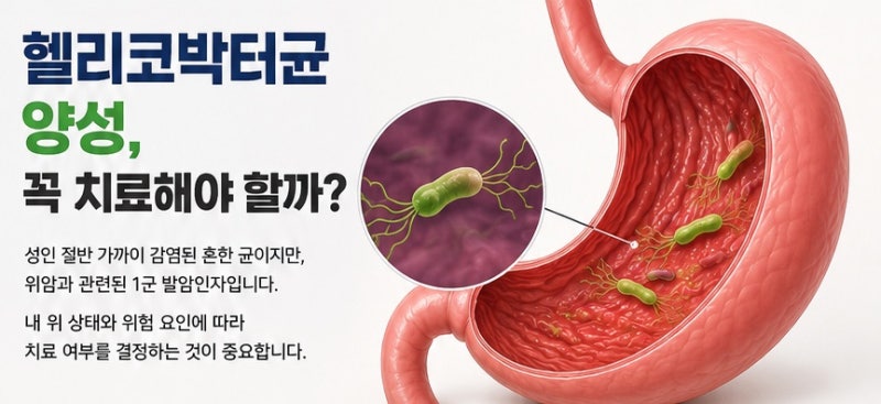 “성인 절반이 양성?” 헬리코박터균, 1군 발암인자라는데 꼭 치료해야 할까