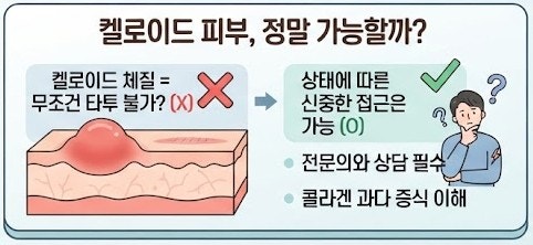 켈로이드 피부 타투 안 된다는 편견을 깨드립니다