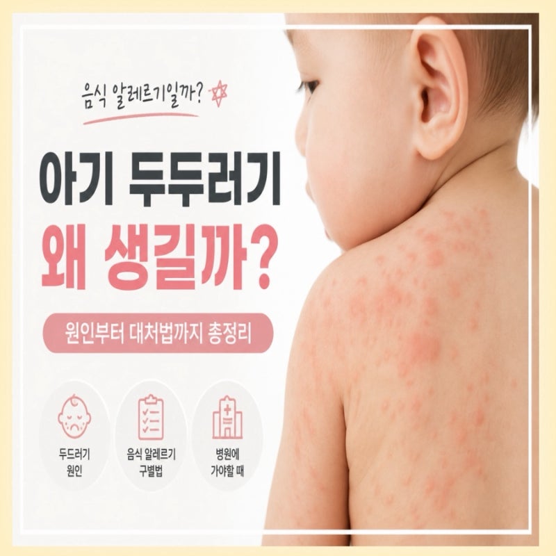 아기 두드러기 왜 생길까? 음식 알레르기일까? 원인부터 대처법까