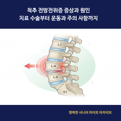 척추 전방전위증 증상과 원인｜치료 수술부터 운동과 주의 사항까지