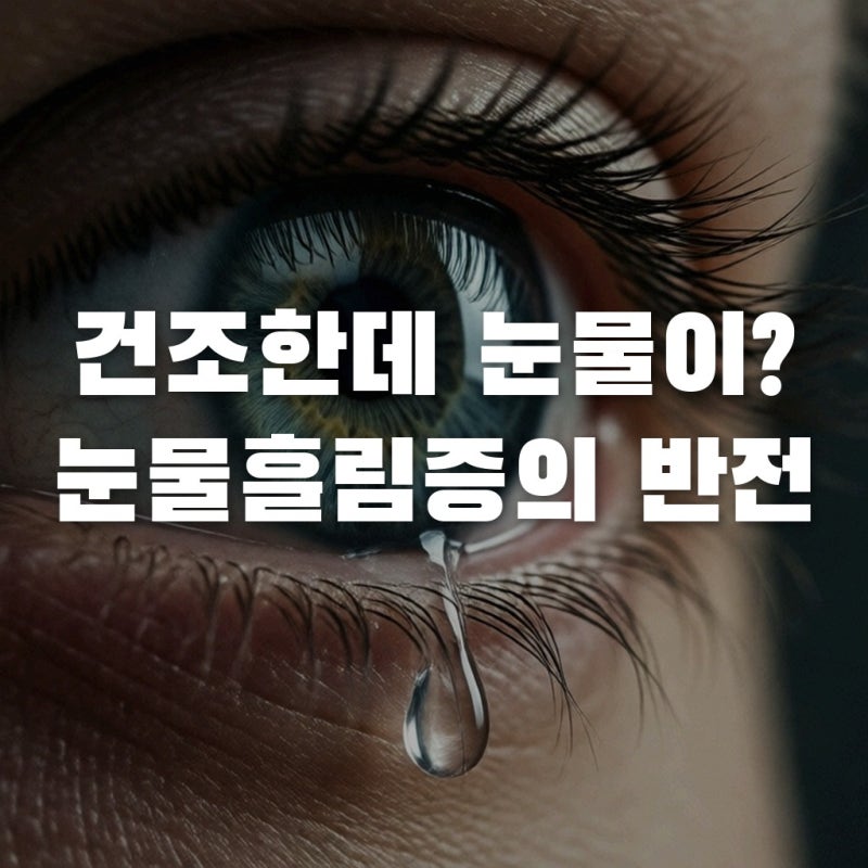 눈이 건조한데 왜 자꾸 눈물이 흐를까? 당신이 몰랐던 '눈물흘림증'의 반전
