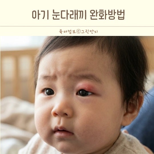 아기 눈 다래끼 생기는 이유? 영유아 어린이 다래끼 증상과 대처법