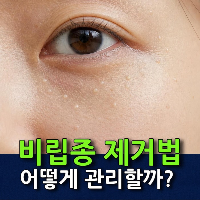 좁쌀같은 알갱이 비립종 원인 및 눈밑 눈꺼풀 제거 관리 방법