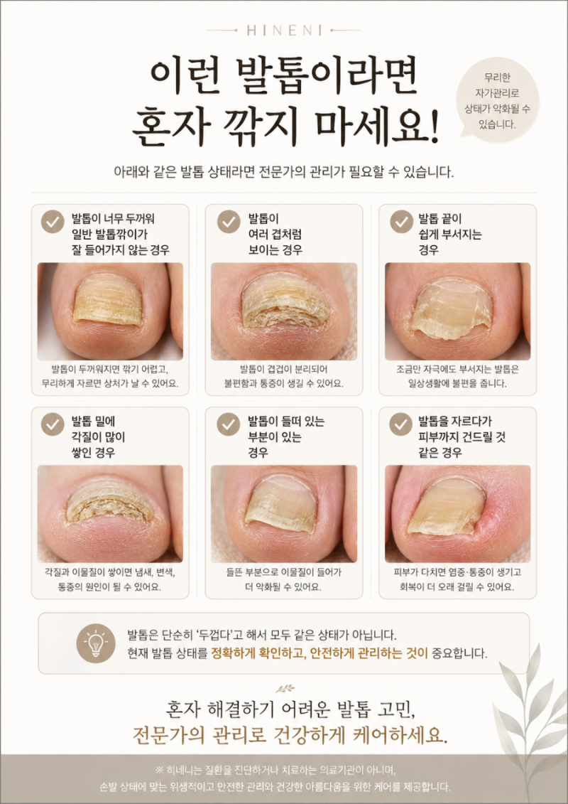 영등포구 여의도 신길동 문제성 무좀발톱 처방약 바르기전에 발톱스케일링 발톱케어 건강한....