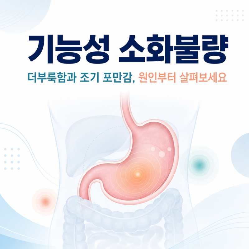 기능성 소화불량
