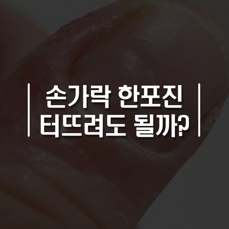 손가락 한포진 초기 증상 5가지|손에 물집 터뜨려도 되나요?