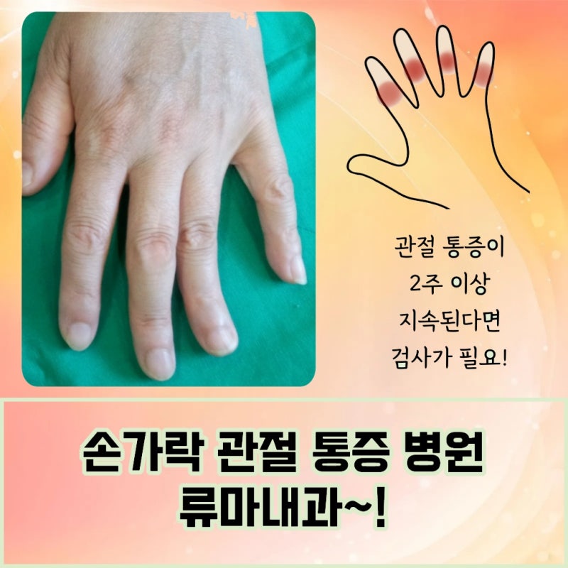 인천 부평 평촌류마티스 잘보는곳을 찾는다면 자가면역 질환 증상을 확인하세요