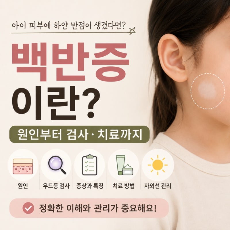 백반증이란? 피부에 하얀 반점이 생기는 이유와 검사·치료 방법