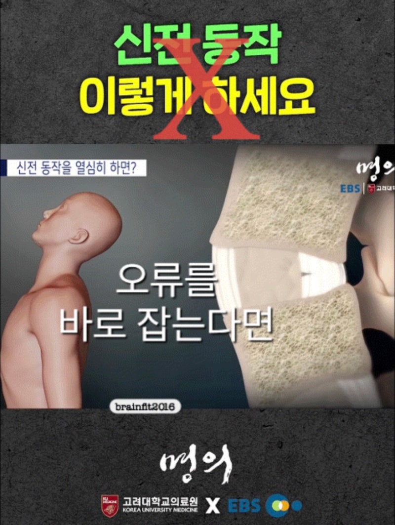 EBS명의) 척추신전 오류 바로잡기