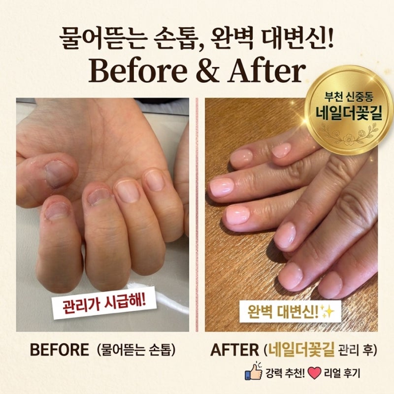 부천 네일더꽃길 상동아크릴연장 물어뜯는 손톱 관리받은 후기 이게 같은 손톱이라고? 전후 ....