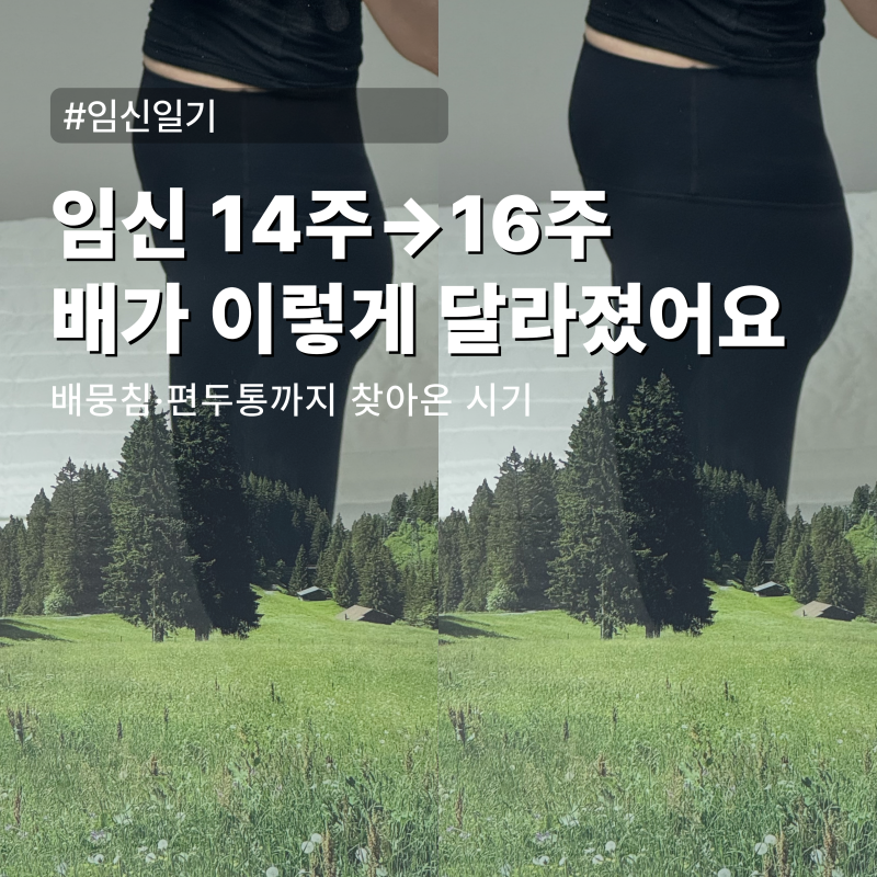 임신 14주~임신 16주 배크기 변화 배뭉침 편두통 초음파 후기