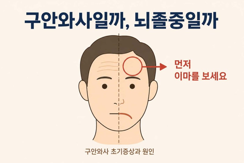 구안와사 초기증상과 원인, 뇌졸중 구분법 [서대문구 남가좌동 한의원]