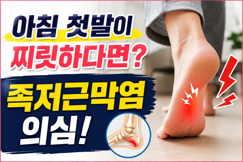 족저근막염 증상과 원인｜아침 첫발이 아픈 이유와 발바닥 통증 스트레칭 3가지
