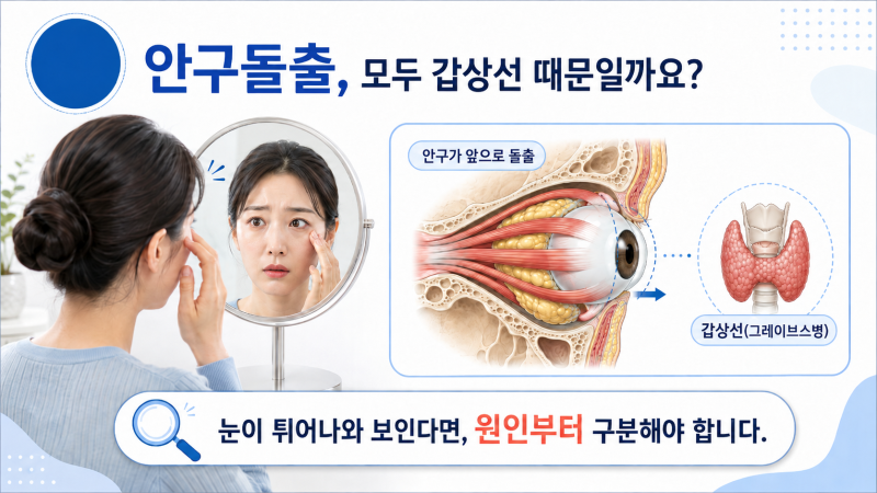 안구돌출 Proptosis, Exophthalmos