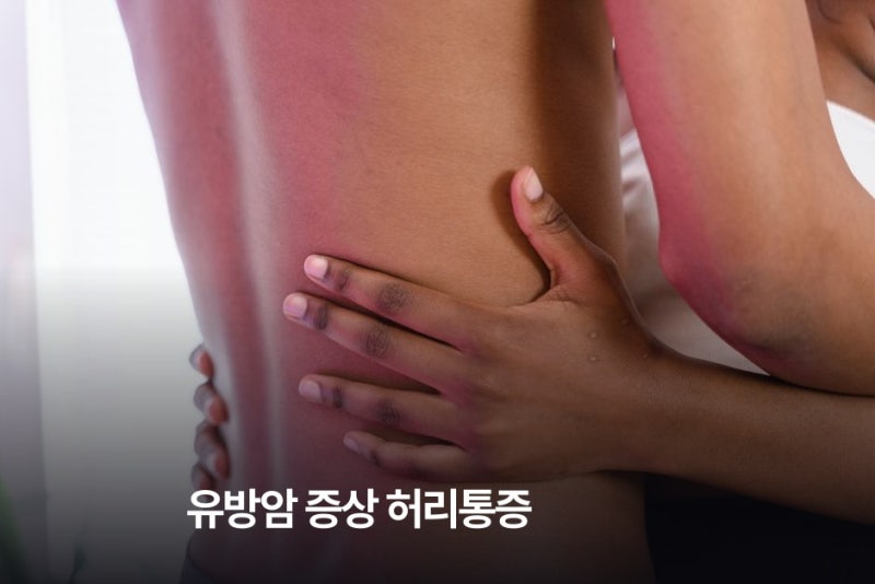 허리 통증으로 발견된 유방암 4기… 척추 전이가 일어나는 까닭