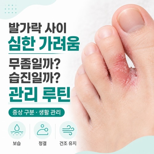 발가락 사이 심한 가려움 무좀일까 습진일까? 관리 루틴