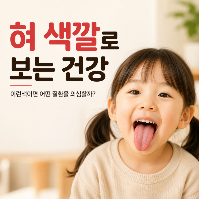 [ 혀 색깔로 보는 건강 ] 이런 색이면 어떤 질환을 의심할까?