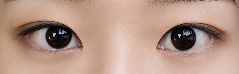 Sinsa's Top Eye Plastic Surgery Clinic: I Wished for Fox-like Eyes Like IVE Liz. Modern Aesthetic Plastic Surgery