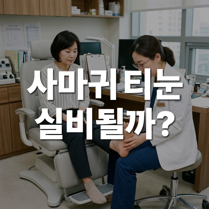 발바닥 사마귀 냉동치료 vs 티눈 실비 청구, 일상생활 지장 기준 알아보기