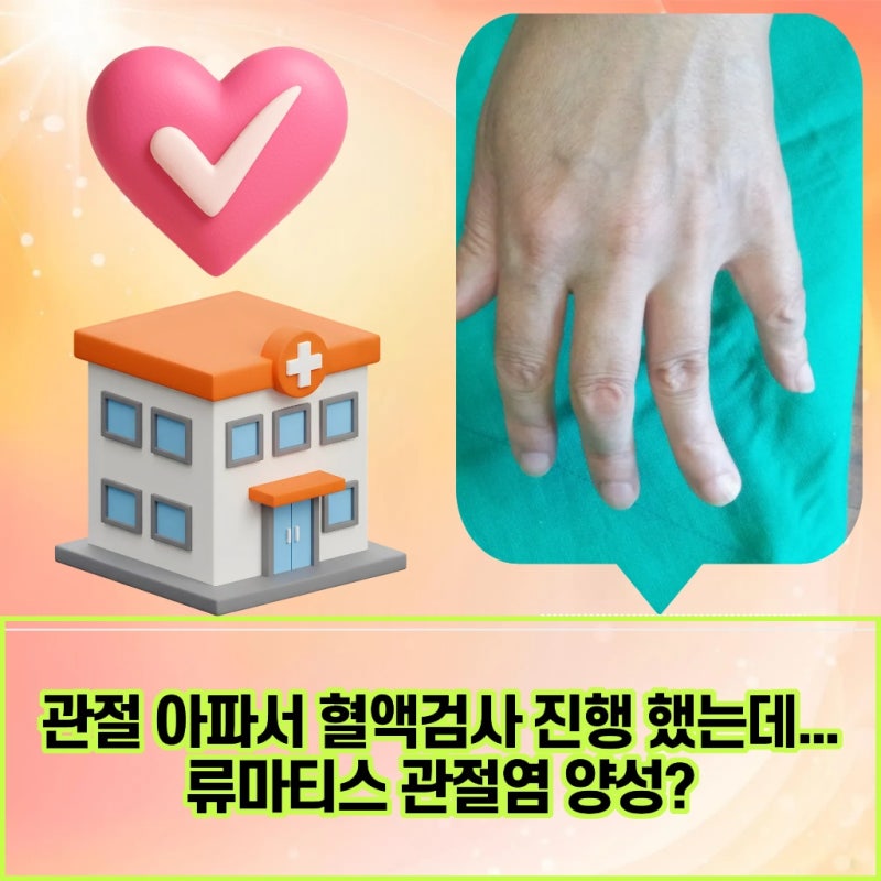 서울 송파구 엄지손가락관절통증 원인이 류마티스관절염일 가능성 확인하기