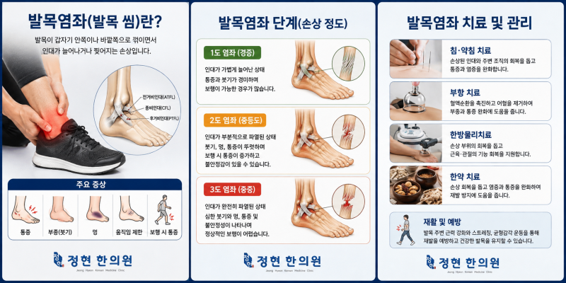 [동작구상도동숭실대역1번출구바로앞정현한의원] 발목을 삐끗했어요! 발목 염좌, 초기에 제....