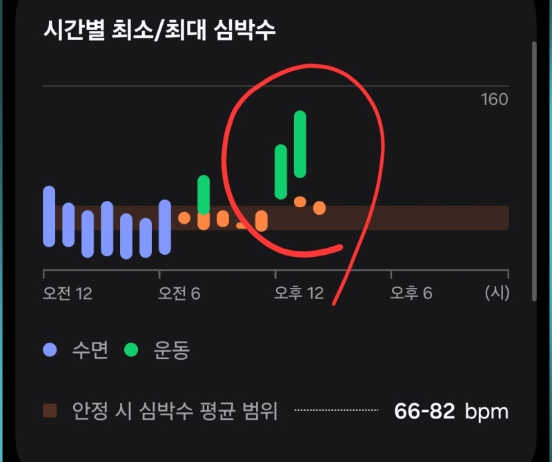 강남 베오미 나팔관 조영술 후기 통증 및 비용