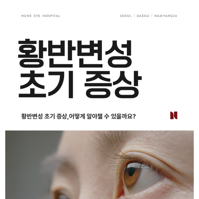 황반변성 초기 증상, 어떻게 알아챌 수 있을까요?