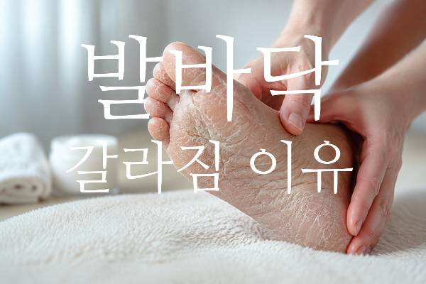 발바닥 갈라짐 이유