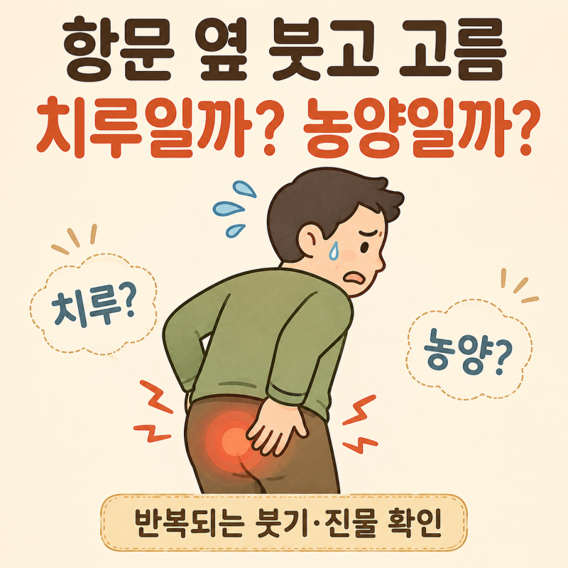 항문 옆이 붓고 고름이 나온다면? 치루·항문주위농양 증상 확인