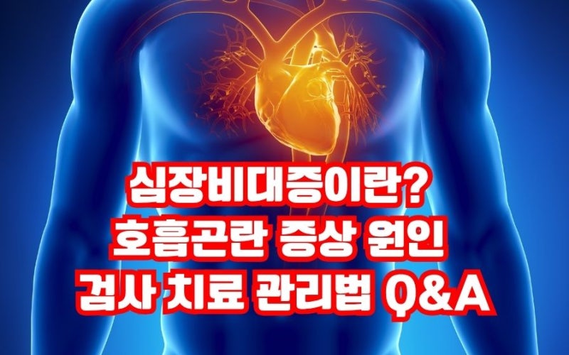 심장비대증이란? 증상 두근거림 호흡곤란 원인 검사 치료 관리법 Q&A
