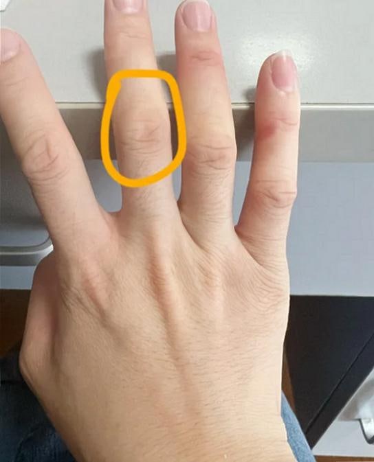손가락 마디통증 원인 감별과 관절별 특징, 검사 기준까지 정리