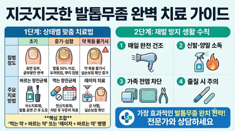 지긋지긋한 발톱무좀, 완벽하게 치료하는법