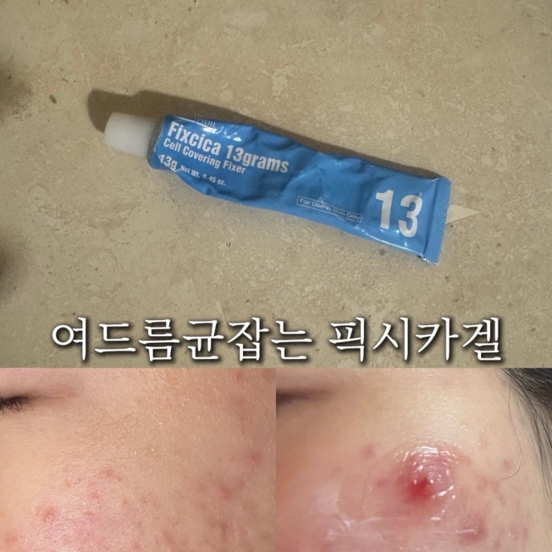 픽시카 패치겔할인 여드름 짠 후 필수템! 구매처 약국,공홈