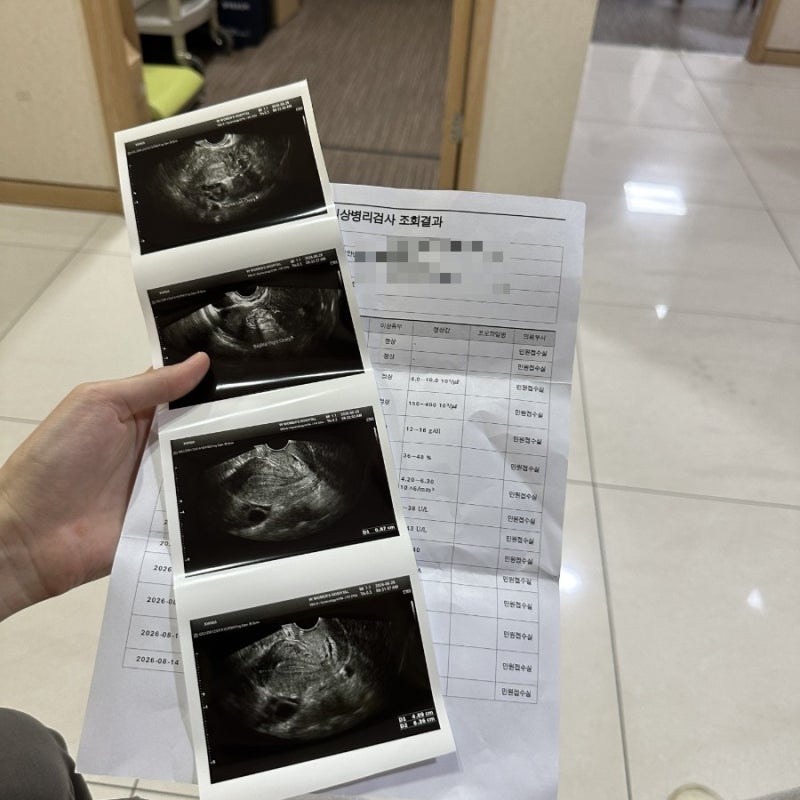 대전신혼부부 무료산전검사지원 '더블유산부인과' 예약방법 추가검사비용 청구후기
