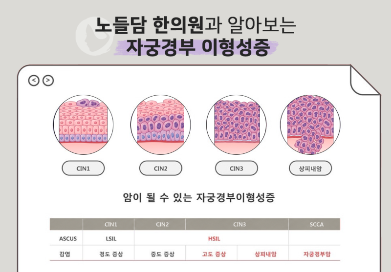 자궁경부이형성증 원인·치료·완치 기간 총정리