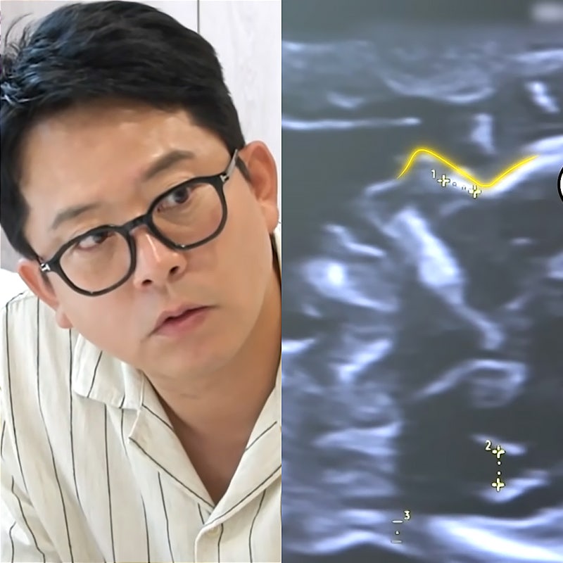 미우새 김준호 김지민 2세 초음파 성별 아들, 엄마들 반응은?